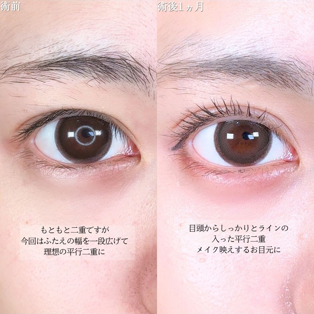 No.16722の症例写真1
